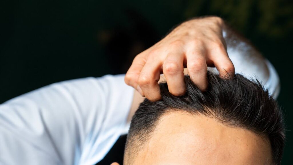 typical hair restoration downtime
